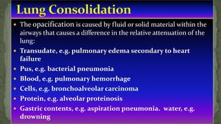  The opacification is caused by fluid or solid material within the
airways that causes a difference in the relative attenuation of the
lung:
 Transudate, e.g. pulmonary edema secondary to heart
failure
 Pus, e.g. bacterial pneumonia
 Blood, e.g. pulmonary hemorrhage
 Cells, e.g. bronchoalveolar carcinoma
 Protein, e.g. alveolar proteinosis
 Gastric contents, e.g. aspiration pneumonia. water, e.g.
drowning
 