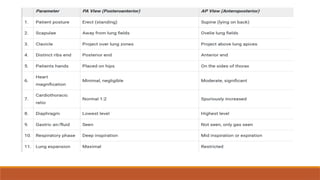 Chest X-Ray Views & Key Radiologic Signs | PPTX