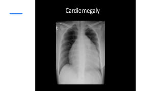 Comprehensive Guide to Chest X-Ray Interpretation and Radiographic ...