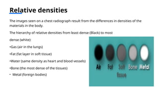 Comprehensive Guide to Chest X-Ray Interpretation and Radiographic ...