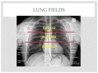 Comprehensive Introduction to Chest X-Ray Imaging Techniques and ...