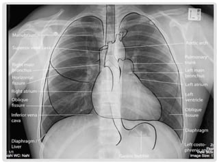 Comprehensive Introduction to Chest X-Ray Imaging Techniques and ...