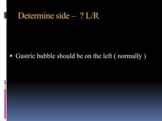 Determine side – ? L/R



 Gastric bubble should be on the left ( normally )
 