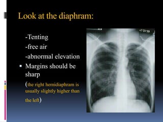 Look at the diaphram:

  -Tenting
  -free air
  -abnormal elevation
 Margins should be
  sharp
  (the right hemidiaphram is
  usually slightly higher than
  the left)
 