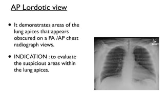 Lordotic View Chest xray -Lateral view shows major anatomical structure in ...