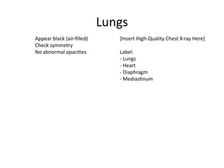 Comprehensive Guide to Normal Chest X-ray Anatomy and Interpretation | PPTX