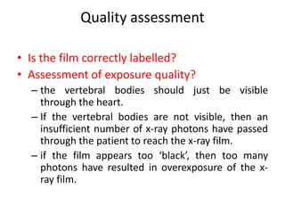 Quality assessment
• Is the film correctly labelled?
• Assessment of exposure quality?
– the vertebral bodies should just be visible
through the heart.
– If the vertebral bodies are not visible, then an
insufficient number of x-ray photons have passed
through the patient to reach the x-ray film.
– if the film appears too ‘black’, then too many
photons have resulted in overexposure of the x-
ray film.
 