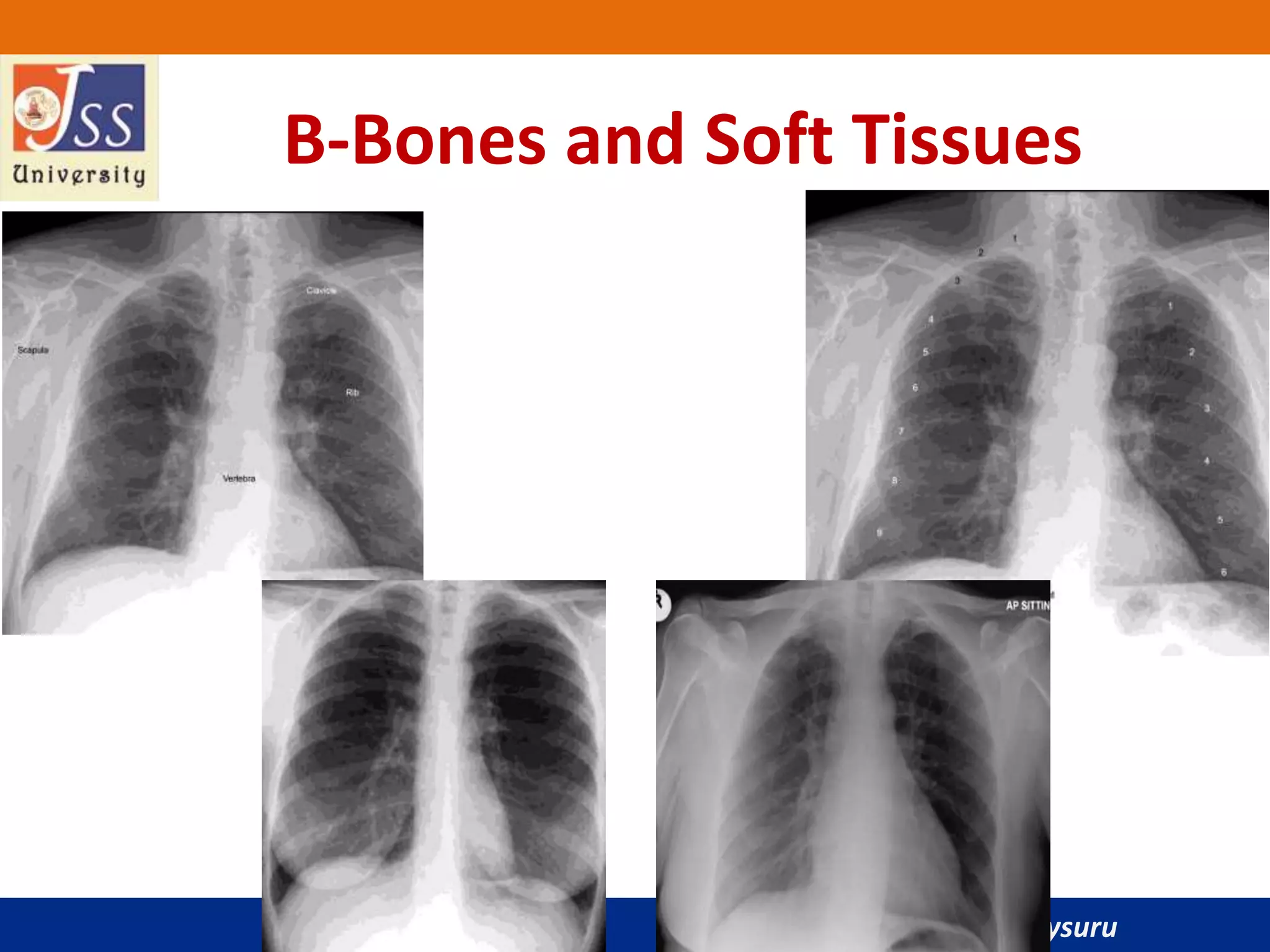 JSS Medical College, Mysuru
B-Bones and Soft Tissues
 