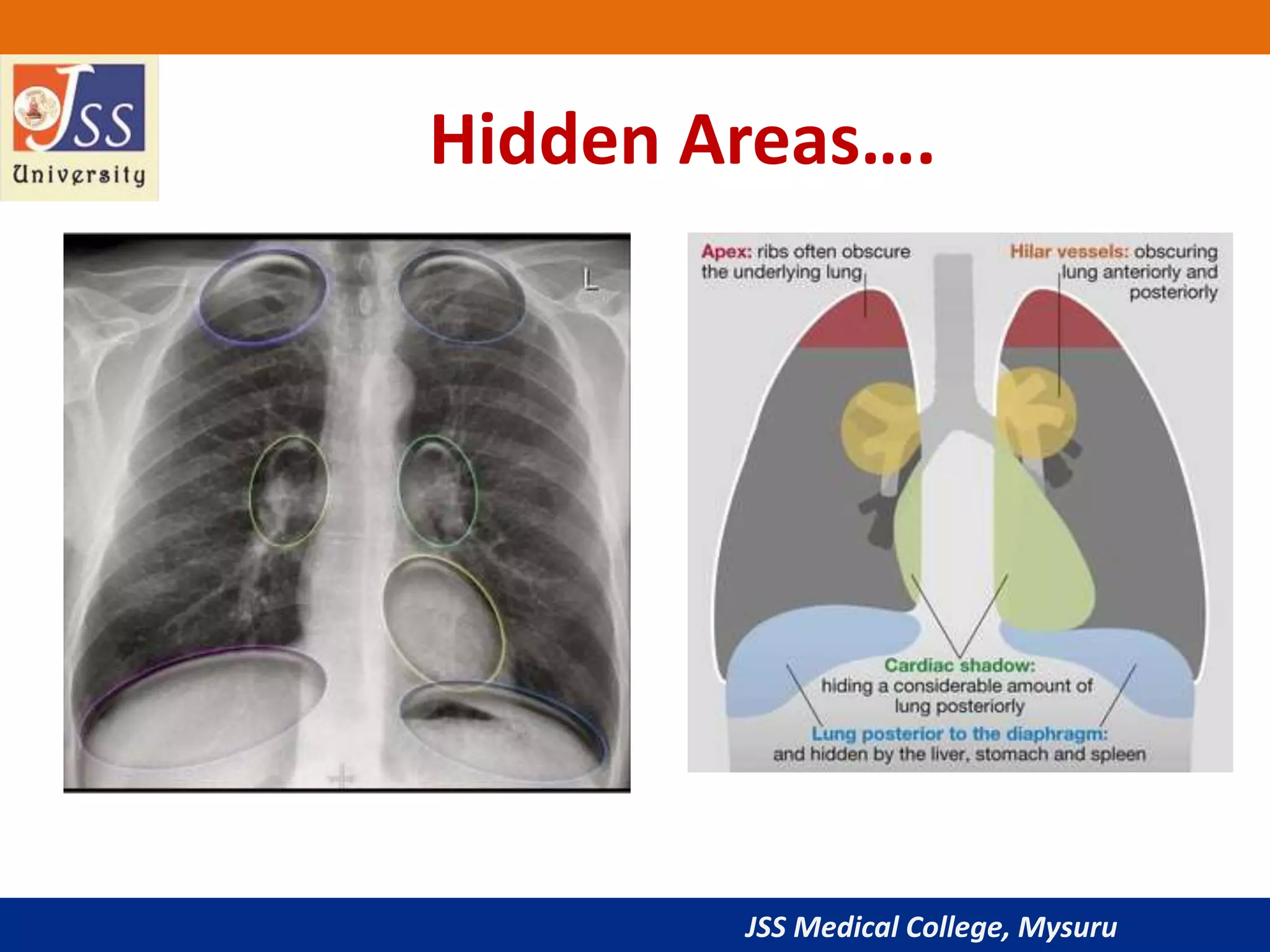 JSS Medical College, Mysuru
Hidden Areas….
 