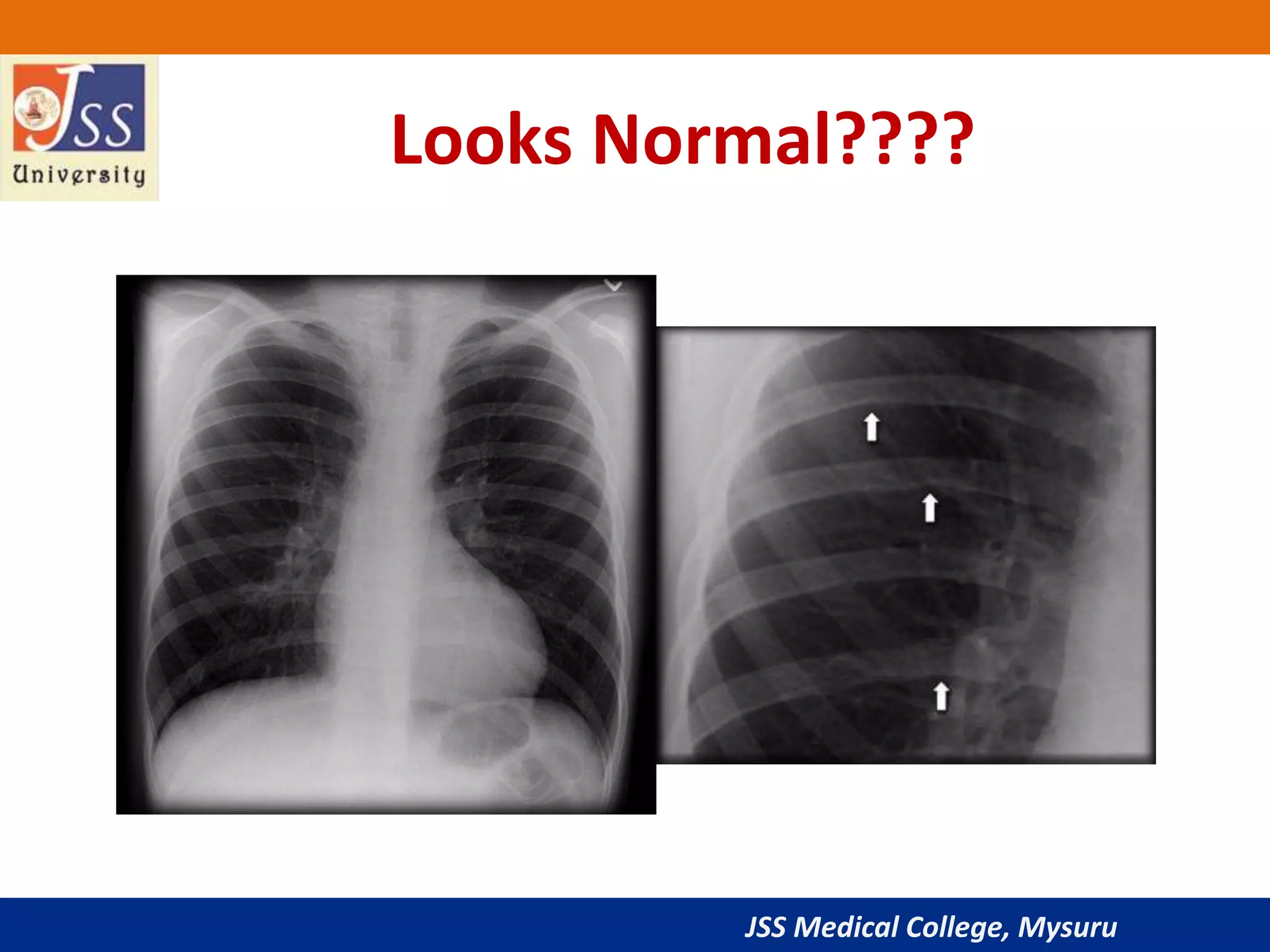 JSS Medical College, Mysuru
Looks Normal????
 
