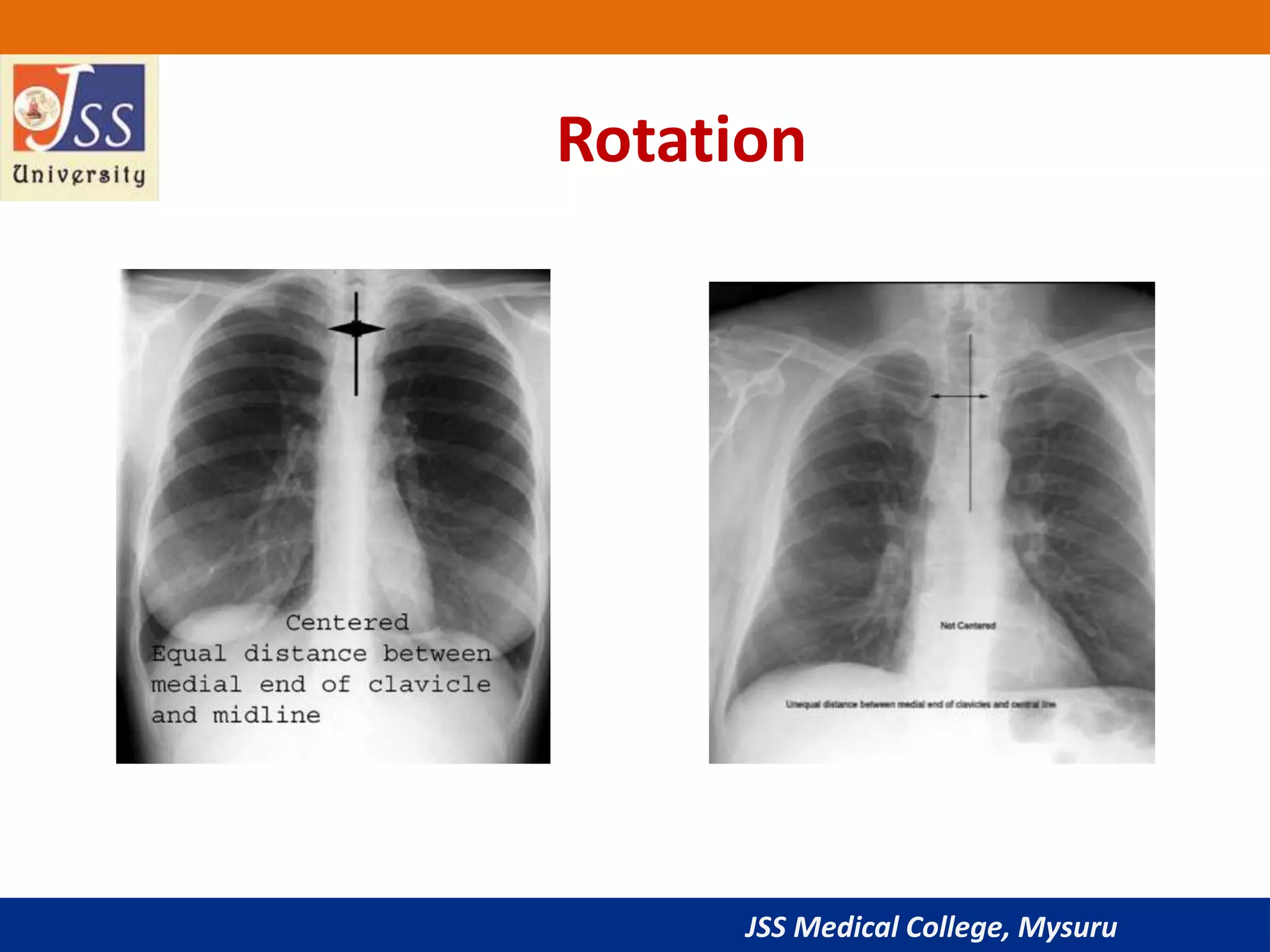 JSS Medical College, Mysuru
Rotation
 