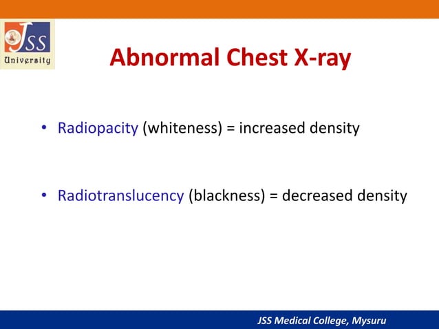 Chest x ray basic interpretation | PPTX