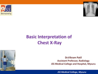 JSS Medical College, Mysuru
Basic Interpretation of
Chest X-Ray
Dr.Vikram Patil
Assistant Professor, Radiology
JSS Medical College and Hospital, Mysuru
 