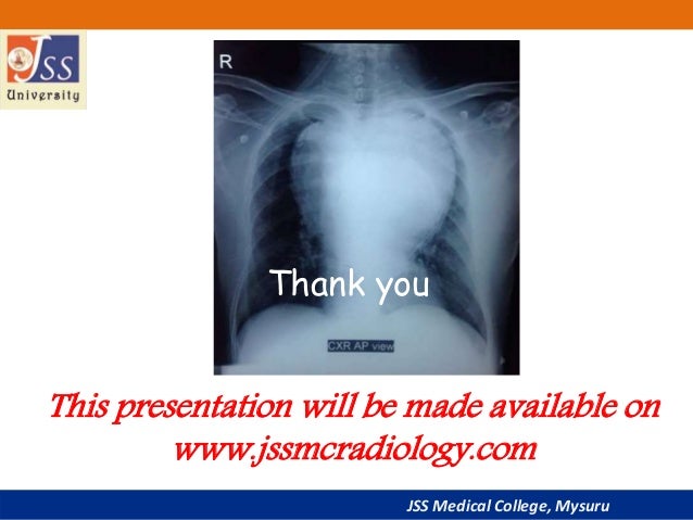 Chest X Ray Basic Interpretation