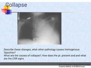 chest Xray checkmate compiled by Mwebaza victor (MBchB) for DR. Moses ...