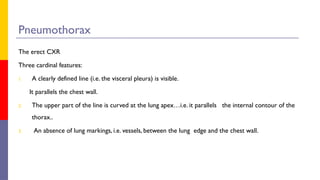 Chest Xray interpretation and normal Abdikadir Hassan .pptx