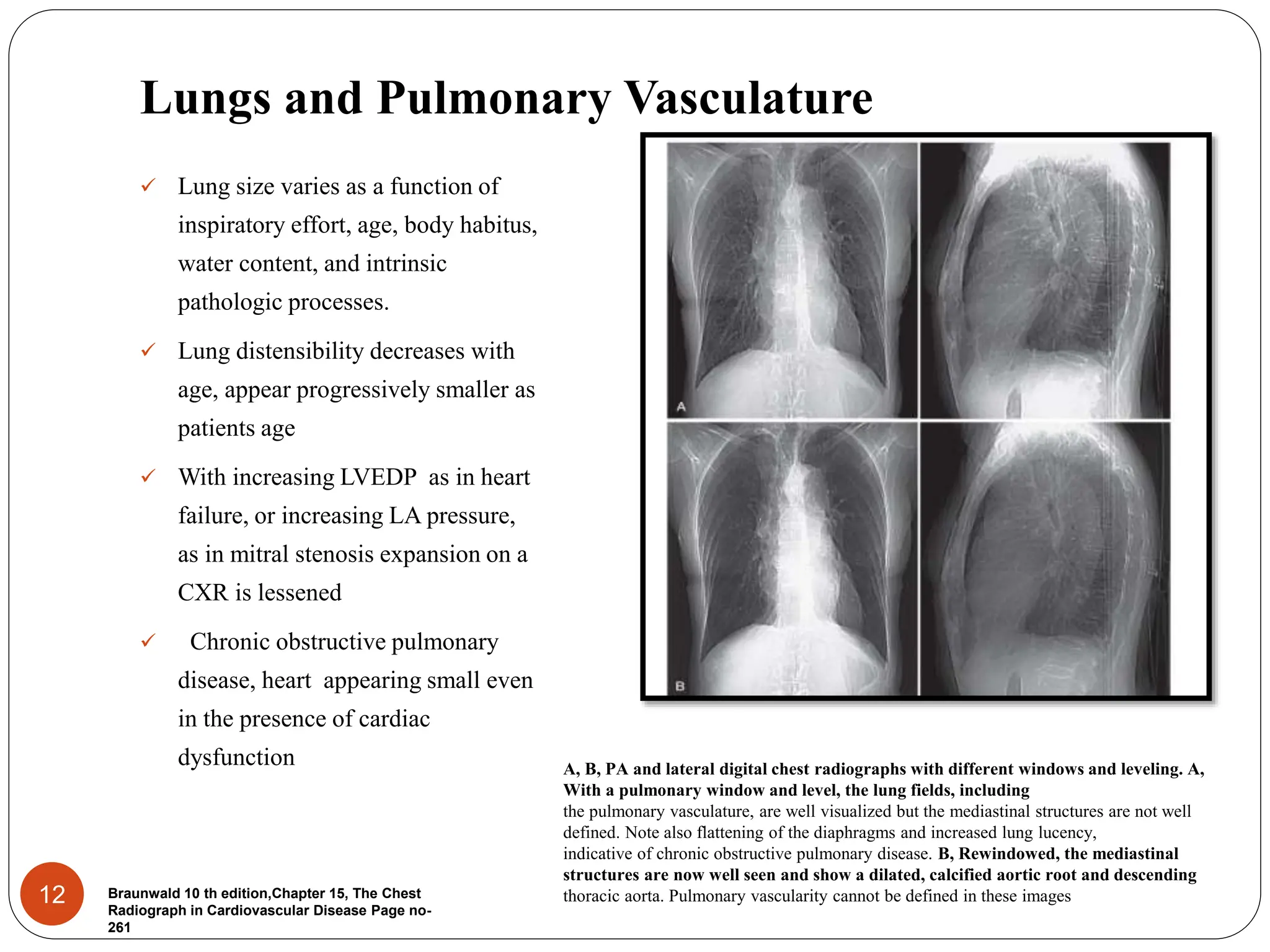 chestxrayforevaluationofcardiovascularsystem-170204135120.pdf