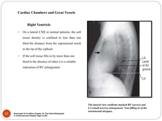 chestxrayforevaluationofcardiovascularsystem-170204135120.pdf