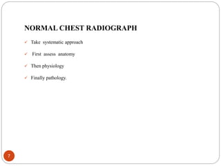 chestxrayforevaluationofcardiovascularsystem-170204135120.pdf