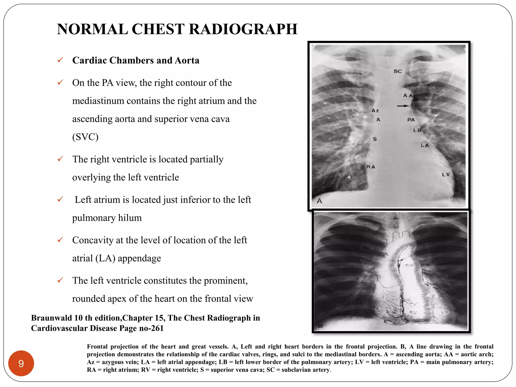 Chest xray for evaluation of cardiovascular system | PPTX