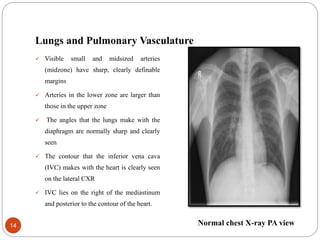 Chest xray for evaluation of cardiovascular system | PPTX