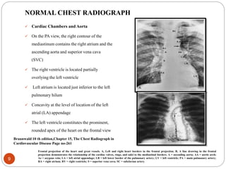 Chest xray for evaluation of cardiovascular system | PPTX