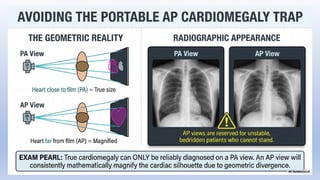 Comprehensive Guide to Chest X-Ray Interpretation Using RIPE and ABCDE ...