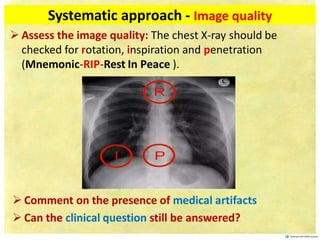 CHEST XRAY FUNDAMENTALS. Slides for The students | PDF