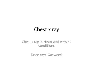 Chest x ray
Chest x ray in Heart and vessels
conditions
Dr ananya Goswami
 