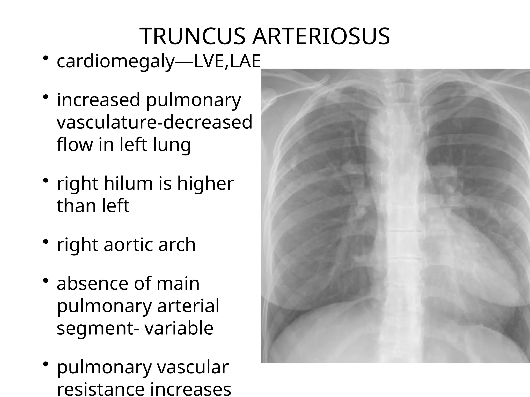 CHEST X RAY IN CONGENITAL HEART DISEASE2.pptx