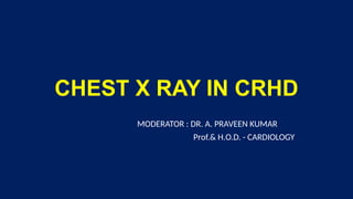 CHEST Xray IN CHRONIC RHEUMATIC HEART DISEASERHD.pptx