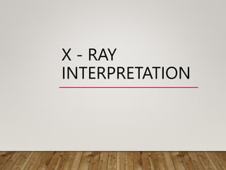 X - RAY
INTERPRETATION
 