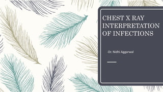 CHEST X RAY
INTERPRETATION
OF INFECTIONS
-Dr. Nidhi Aggarwal
 