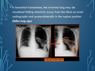 Chest_xray_in_trauma and trauma[PS].pptx