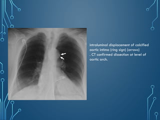 Chest_xray_in_trauma and trauma[PS].pptx