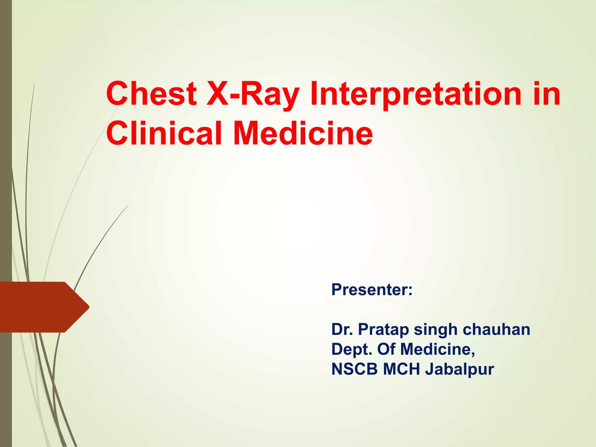 Chest Xray - How to read & interpret | PPTX
