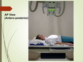 Chest Xray - How to read & interpret | PPTX