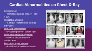 Chest XRay Normal vs Abnormal A Complete Visual Guide By Durjay Laha ...