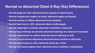 Chest XRay Normal vs Abnormal A Complete Visual Guide By Durjay Laha ...