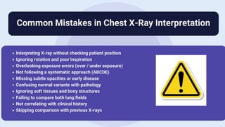 Chest XRay Normal vs Abnormal A Complete Visual Guide By Durjay Laha ...