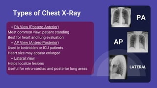 Chest XRay Normal vs Abnormal A Complete Visual Guide By Durjay Laha ...