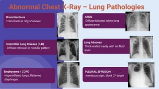 Chest XRay Normal vs Abnormal A Complete Visual Guide By Durjay Laha ...