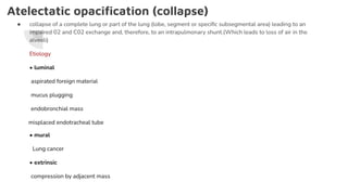Atelectatic opaciﬁcation (collapse)
● collapse of a complete lung or part of the lung (lobe, segment or speciﬁc subsegmental area) leading to an
impaired 02 and C02 exchange and, therefore, to an intrapulmonary shunt.(Which leads to loss of air in the
alveoli)
Etiology
• luminal
aspirated foreign material
mucus plugging
endobronchial mass
misplaced endotracheal tube
• mural
Lung cancer
• extrinsic
compression by adjacent mass
 