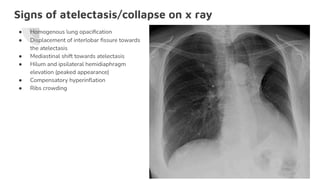 Signs of atelectasis/collapse on x ray
● Homogenous lung opaciﬁcation
● Displacement of interlobar ﬁssure towards
the atelectasis
● Mediastinal shift towards atelectasis
● Hilum and ipsilateral hemidiaphragm
elevation (peaked appearance)
● Compensatory hyperinﬂation
● Ribs crowding
 