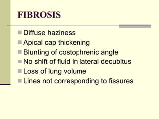 FIBROSIS Diffuse haziness  Apical cap thickening  Blunting of costophrenic angle  No shift of fluid in lateral decubitus  Loss of lung volume  Lines not corresponding to fissures  