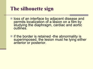 The silhouette sign loss of an interface by adjacent disease and permits localization of a lesion on a film by studying the diaphragm, cardiac and aortic outlines. if the border is retained -the abnormality is superimposed, the lesion must he lying either anterior or posterior.  