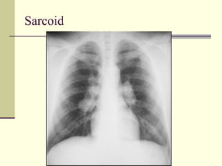 Sarcoid 