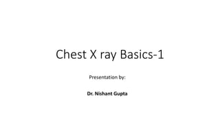 Chest X ray Basics-1
Presentation by:
Dr. Nishant Gupta
 