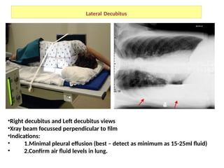 Imaging in chest radiology Radiographs etc | PPTX