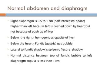 Chest X Ray interpretation Felson radiology.pptx